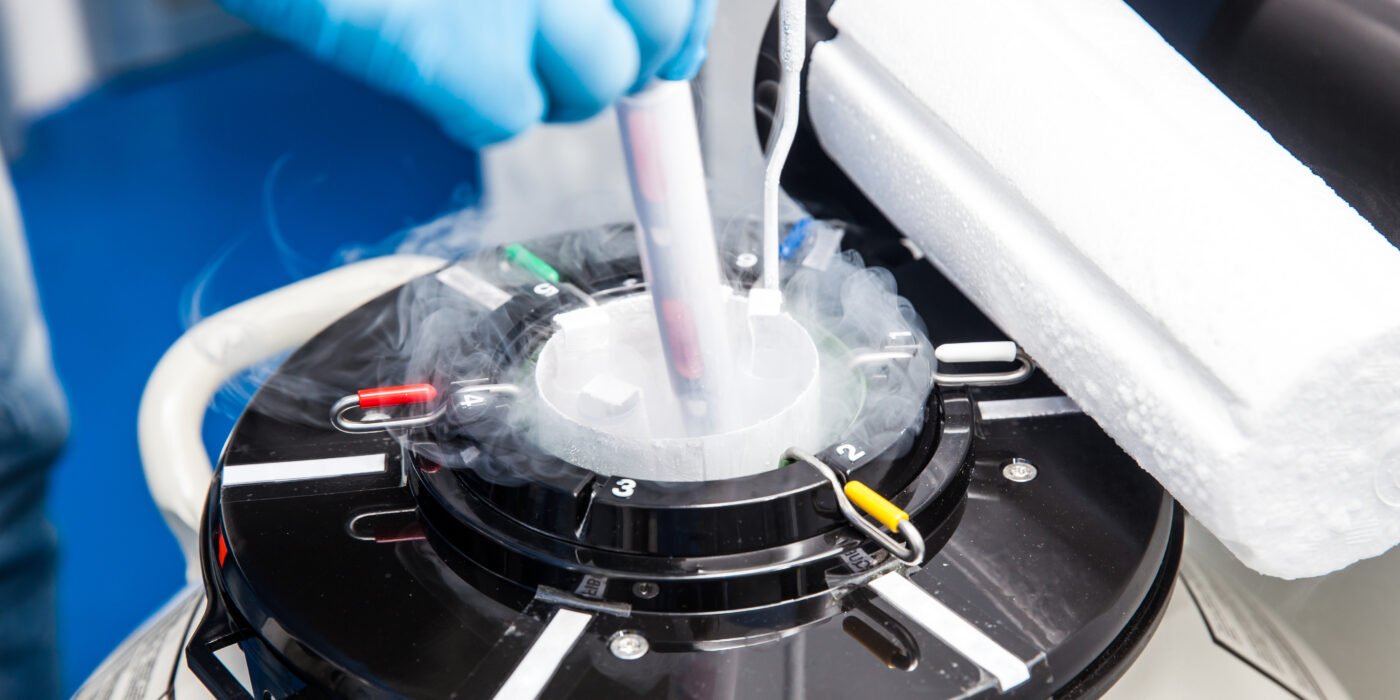 A hand in a glove holding a tube from a container with liquid nitrogen during the egg cell cryopreservation process, with visible steam rising due to the extremely low temperature